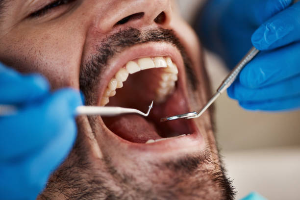 Professional Emergency Dental Service in GA